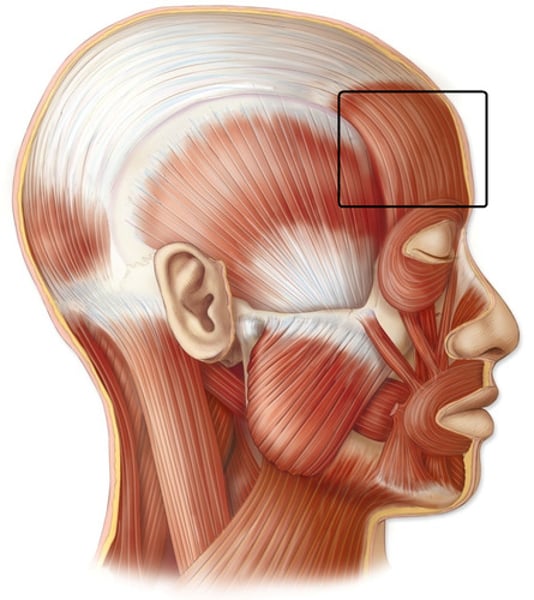 <p>Origin: epicranial aponeurosis<br>Insertion: skin of forhead and eyebrows<br>Action: elevates eyebrows and scalp</p>
