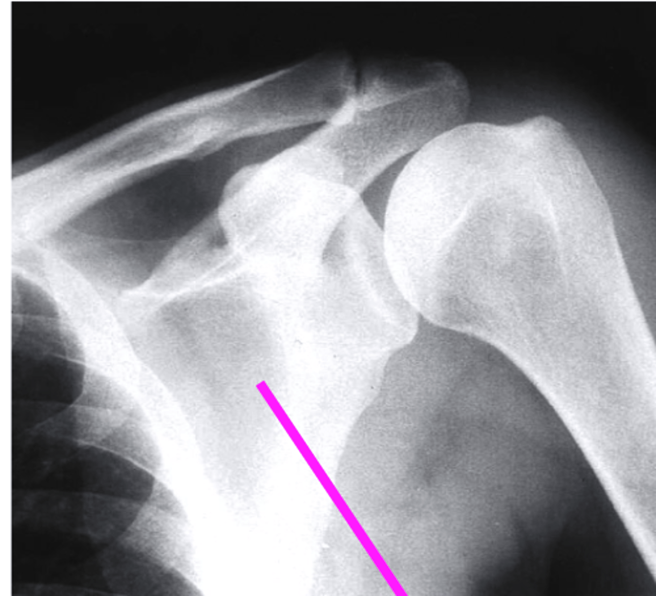 <p>what does the pink line point to?</p>