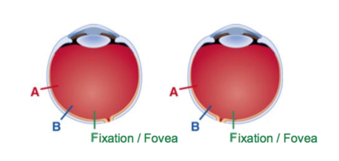 <p>two points on the left and right retina that are the same degree of distance from the center</p>