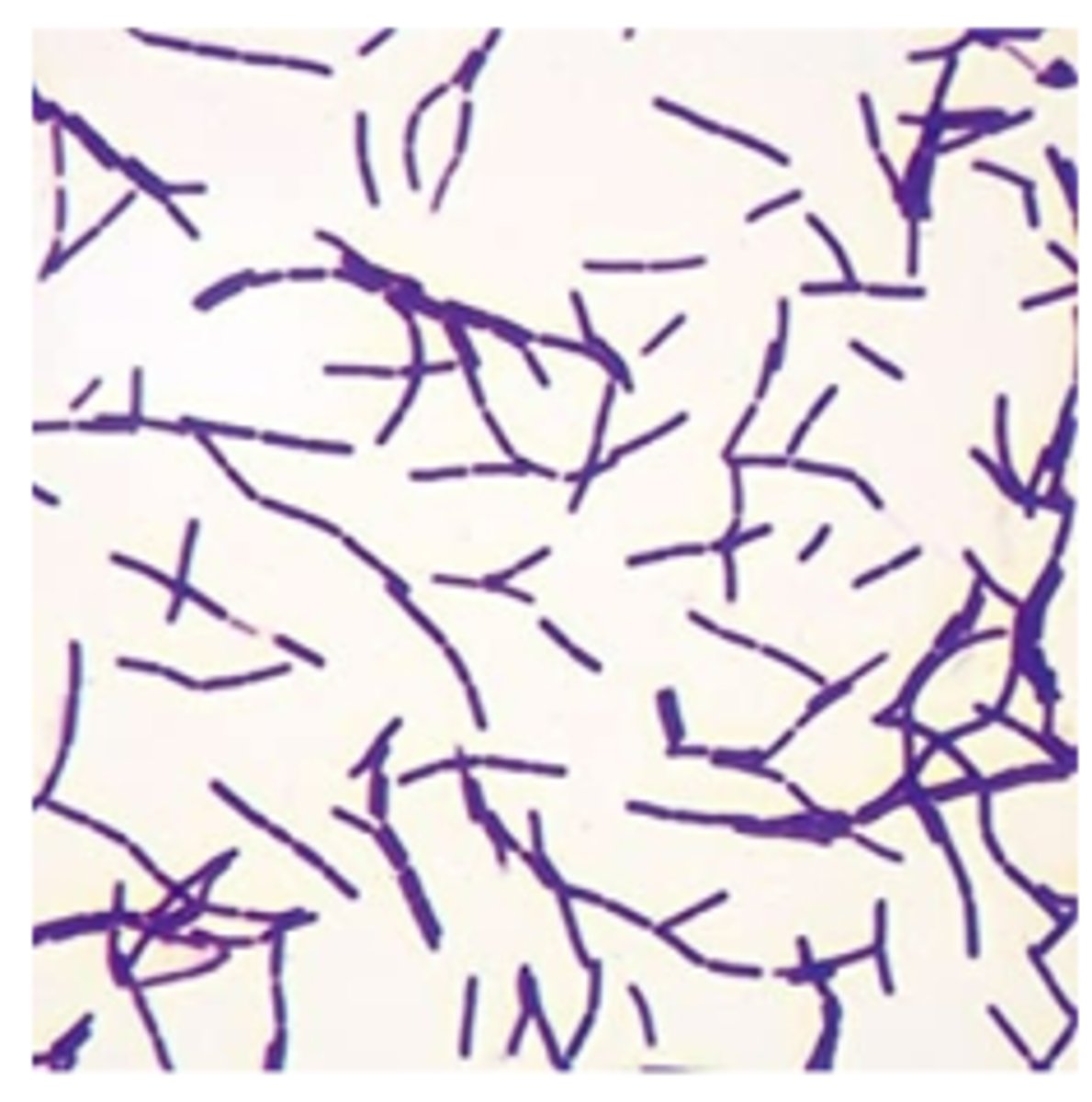 <p>Which Bacteria is this? (shape)</p>