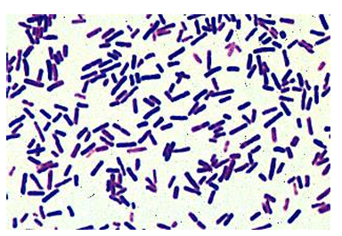 <p>gram positive bacilli</p>