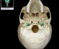<p><span>Irregularly-shaped opening<br>Superior opening (posterior cranial fossa)<br>Inferior opening (base of skull)<br>Posterior to external opening of carotid canal<br>Traversed by internal jugular vein, glossopharyngeal nerve (CN IX), vagus nerve (CN X), and accessory nerve (CN XI</span></p>