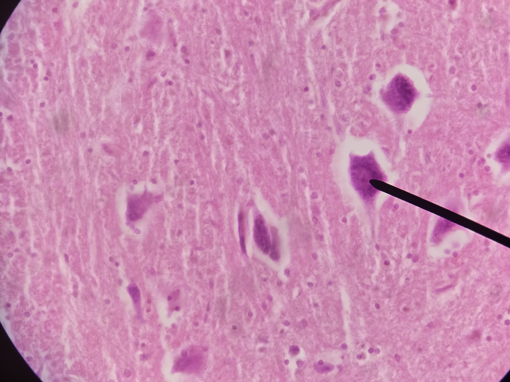 <p>Name Type of Neuron and its Function</p>
