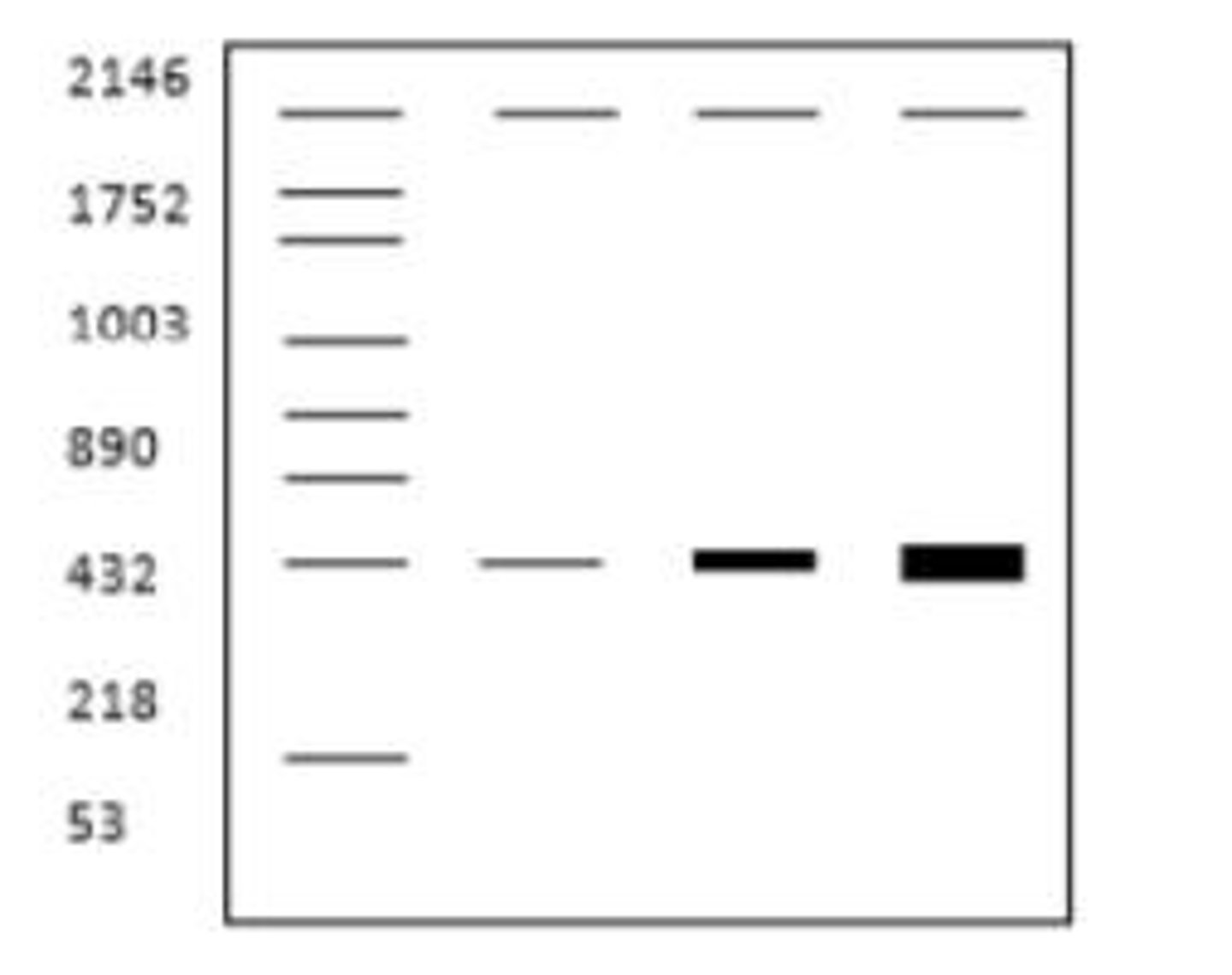 <p>A laboratory method used to separate DNA fragments based on their size.</p>