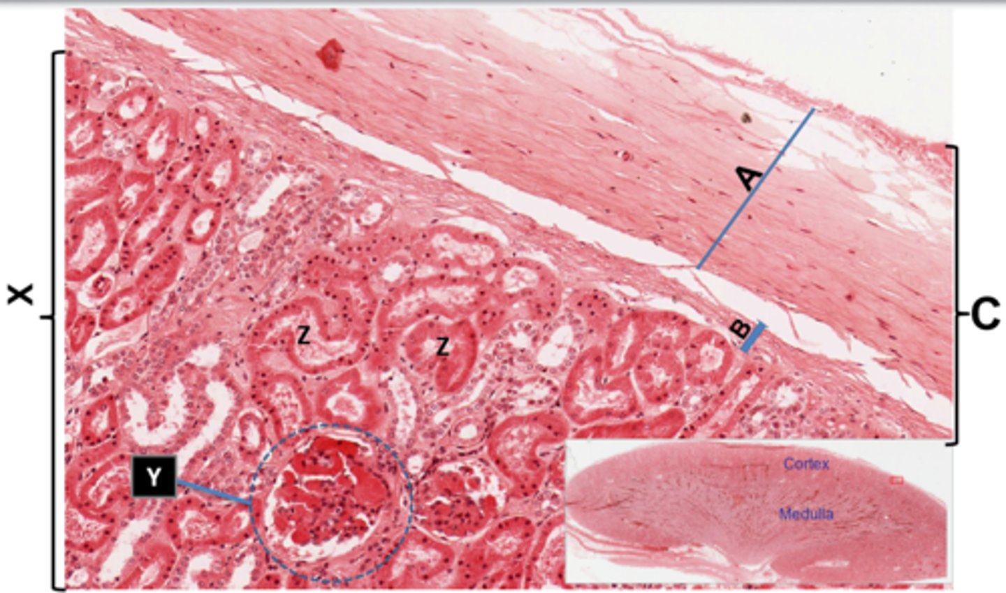 <p>Label this histological slide of the kidney capsule region</p>