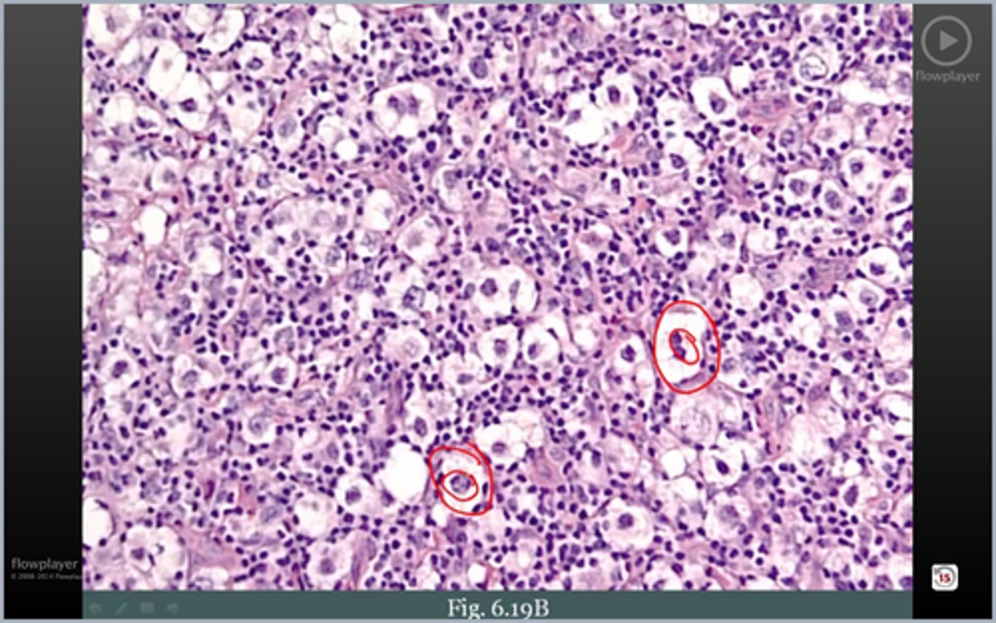 <p>Cx RS Cells</p>