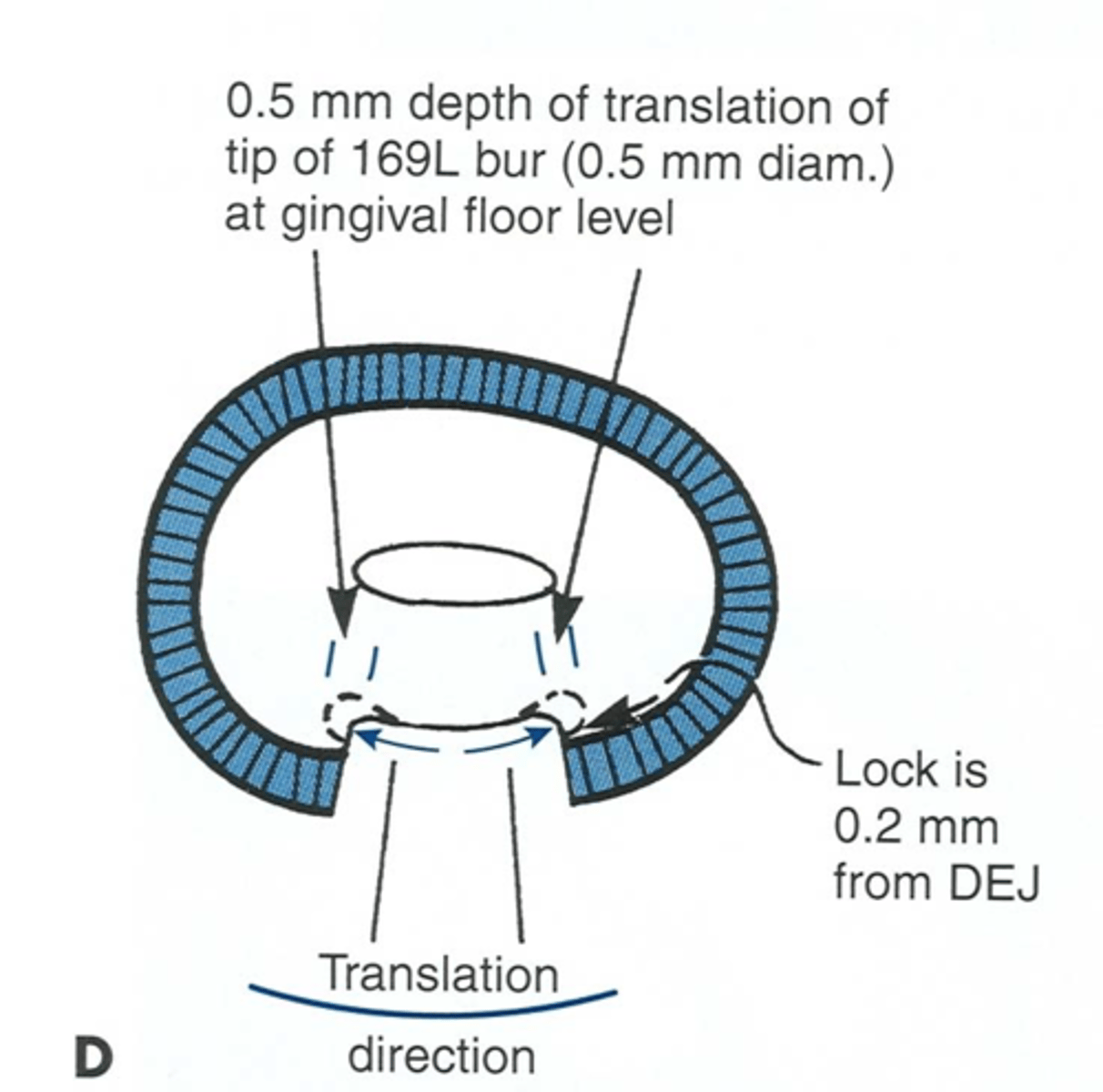 <p>0.5mm inside DEJ</p>
