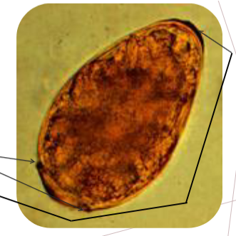 <ul><li><p><span>All species have basically same morphology</span></p><ul><li><p><span>80-120 x 48-60 um</span></p></li><li><p><span>Shaped like a chicken egg</span></p></li><li><p><span>Dark yellow brown</span></p></li><li><p><span>Thick smooth shell</span></p></li><li><p><span><u>Prominent shouldered operculum</u></span></p></li><li><p><span><u>Thickening of abopercular end</u></span></p></li></ul></li></ul><p></p>