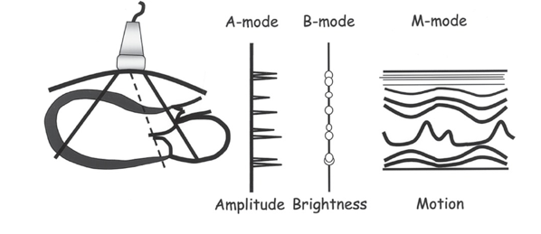 <ul><li><p><strong>Display Options (cont.)</strong></p><p>-<strong> M-mode</strong> (motion mode) documents the movement of structures in the body along a single scan line.</p><ul><li><p>The y-axis shows depth; the x-axis shows time.</p></li><li><p>M-mode is used to demonstrate fetal heart rate and in echocardiography as a critical part of standard protocols.</p></li></ul><p>- The original ultrasound machines provided static images; now we are able to use <strong>real-time scanners</strong>.</p></li></ul><p></p>