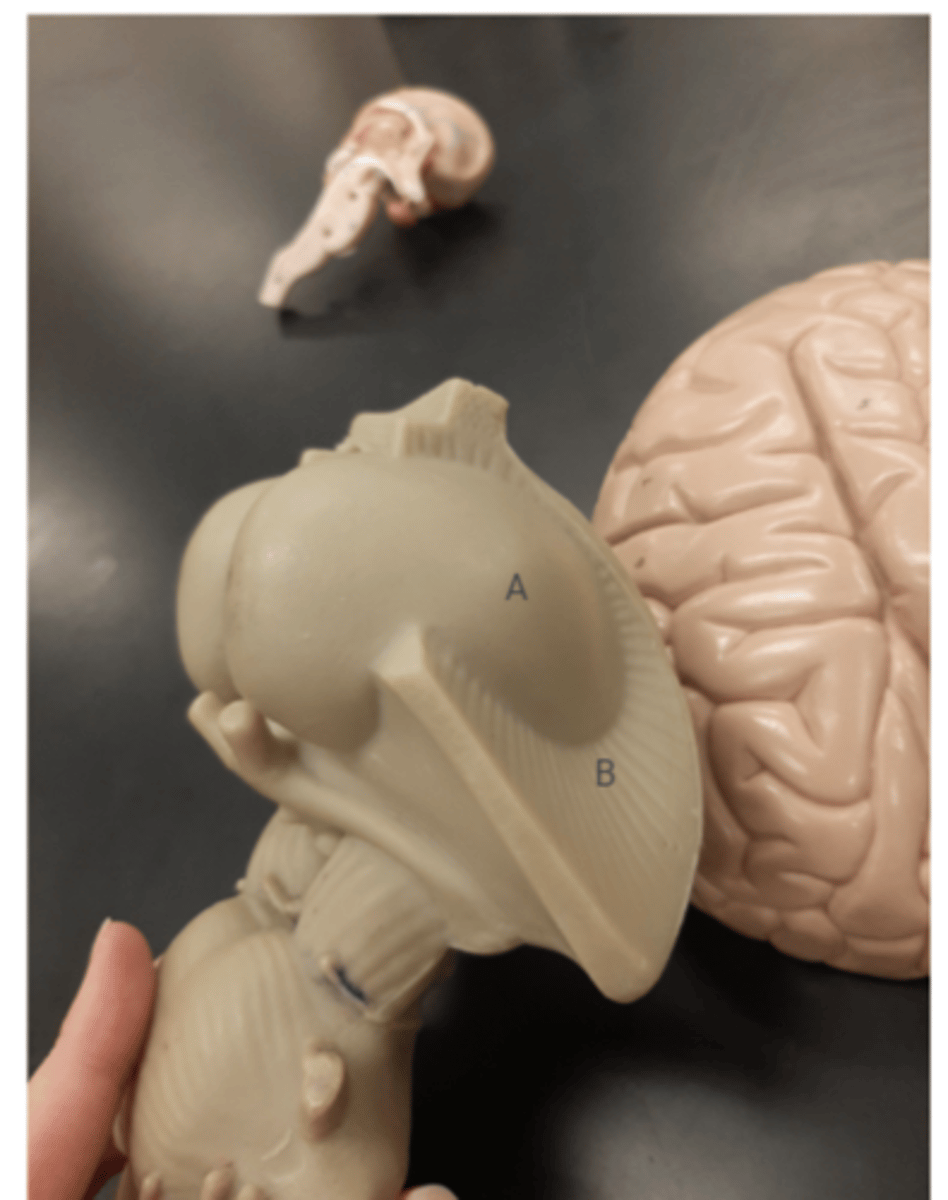 <p>Label this image of the brainstem model</p>