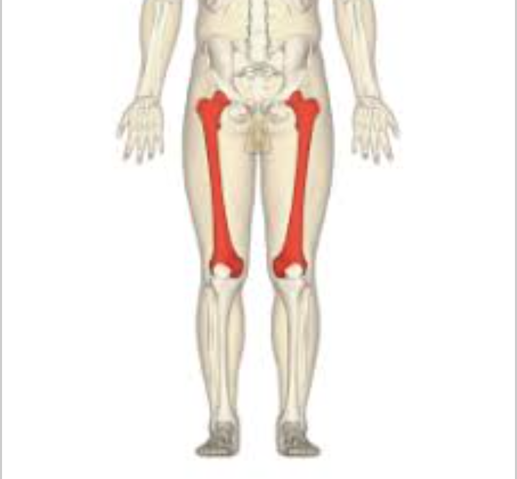 <p>lateral, proximal femur</p>