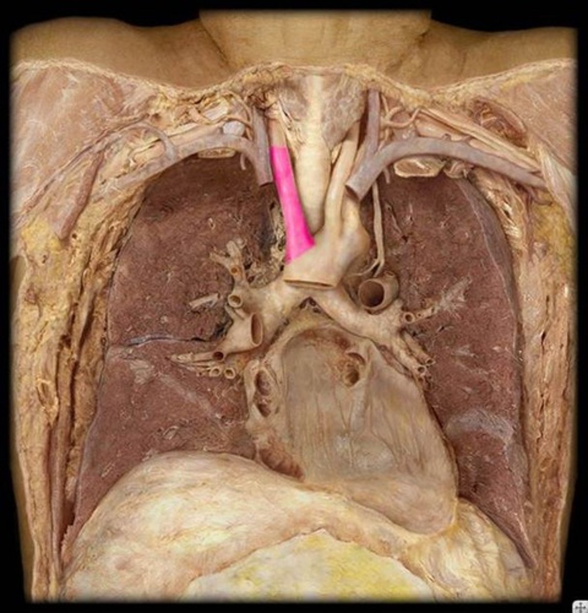 <p>Name this vessel.</p>