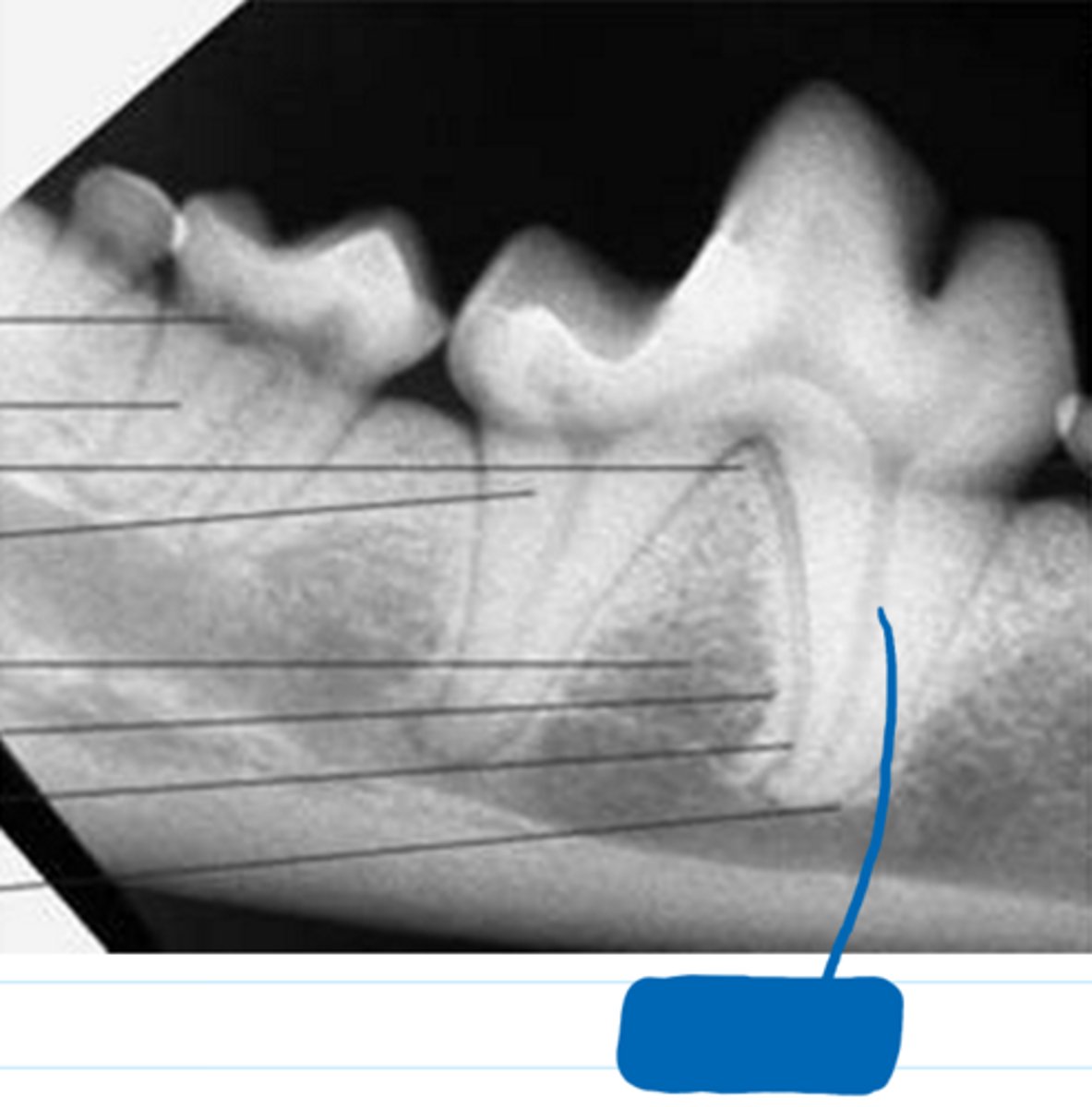 <p>What is the blue box in the image pointing to?</p>