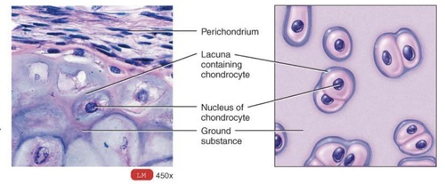 <p>What type of cartilage is this ?</p>