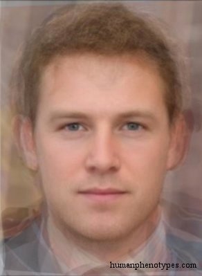 <p>Identify this Phenotype</p>