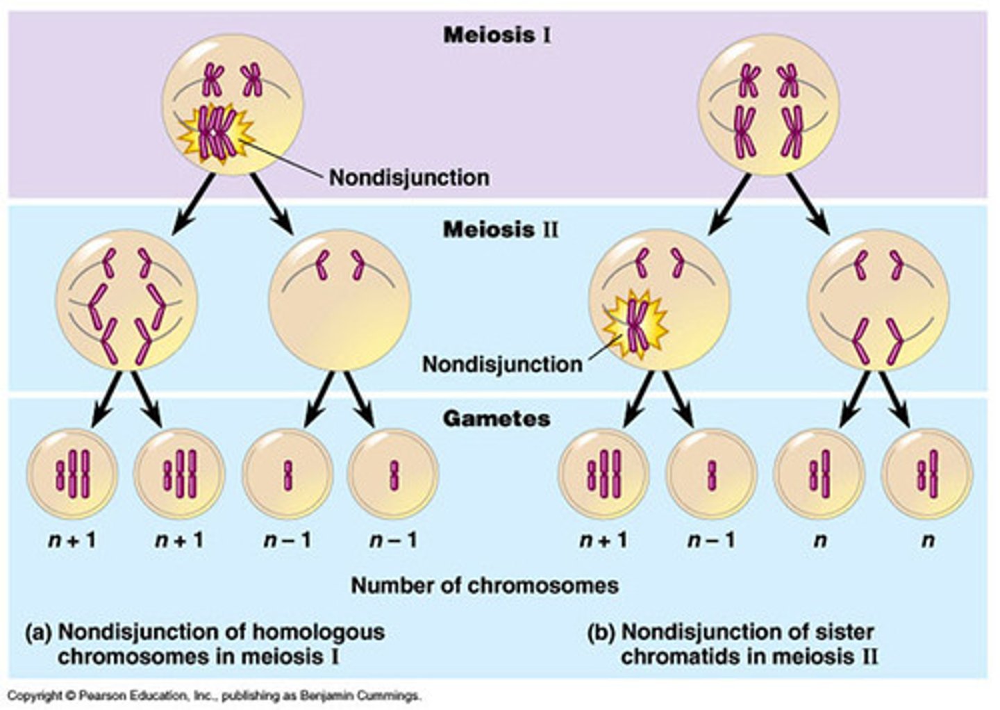 <p>Variation in chromosome number involving only part of the chromosome set. The simplest type is when only one kind of chromosome is involved. Bearing in mind the normal diploid set is 2n:</p><p>- Monosomy: only 1 chromosome is present instead of the usual 2 (2n-1)</p><p>- Trisomy: 3 copies are present instead of the usual 2 (2n+1)</p><p>- Tetrasomy: 4 copies are present instead of the usual 2 (2n+2)</p><p>Aneuploidy results from the failure of chromosomes to separate during cell division. This is called non-disjunction and can happen during meiosis or mitosis. Instead of moving to opposite poles of the spindle, a pair of chromosomes (or chromatids) moves to the same pole, where one daughter cell receives both chromatids (n+1) whereas the other receives none (n-1). When a normal gamete (n) joins with an (n+1) gamete, the result is a trisomic. If a normal gamete joins with an (n-1), the result is a monosomic.</p>