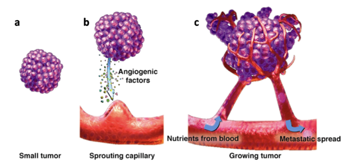 <p>Det kallas ofta <strong>neovaskulisering</strong> och är patologiskt. Tumören skapar en<strong> pro-angiogen</strong> miljö genom utsläpp av olika faktorer:</p><ul><li><p>PDGF</p></li><li><p>VEGF</p></li><li><p>FGF</p></li></ul>