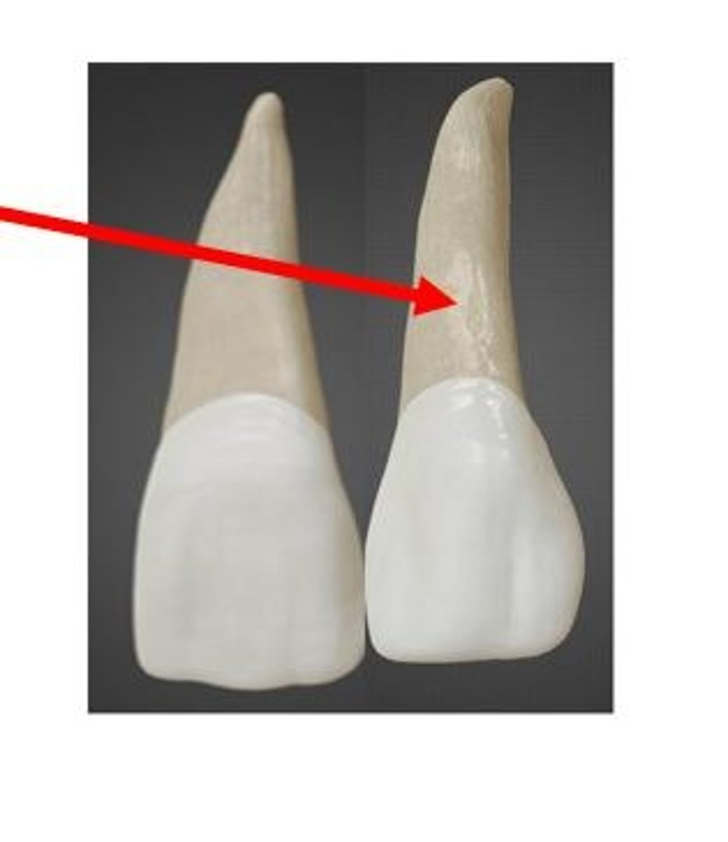 <p>Using the Universal Numbering System, what tooth number is this?</p>