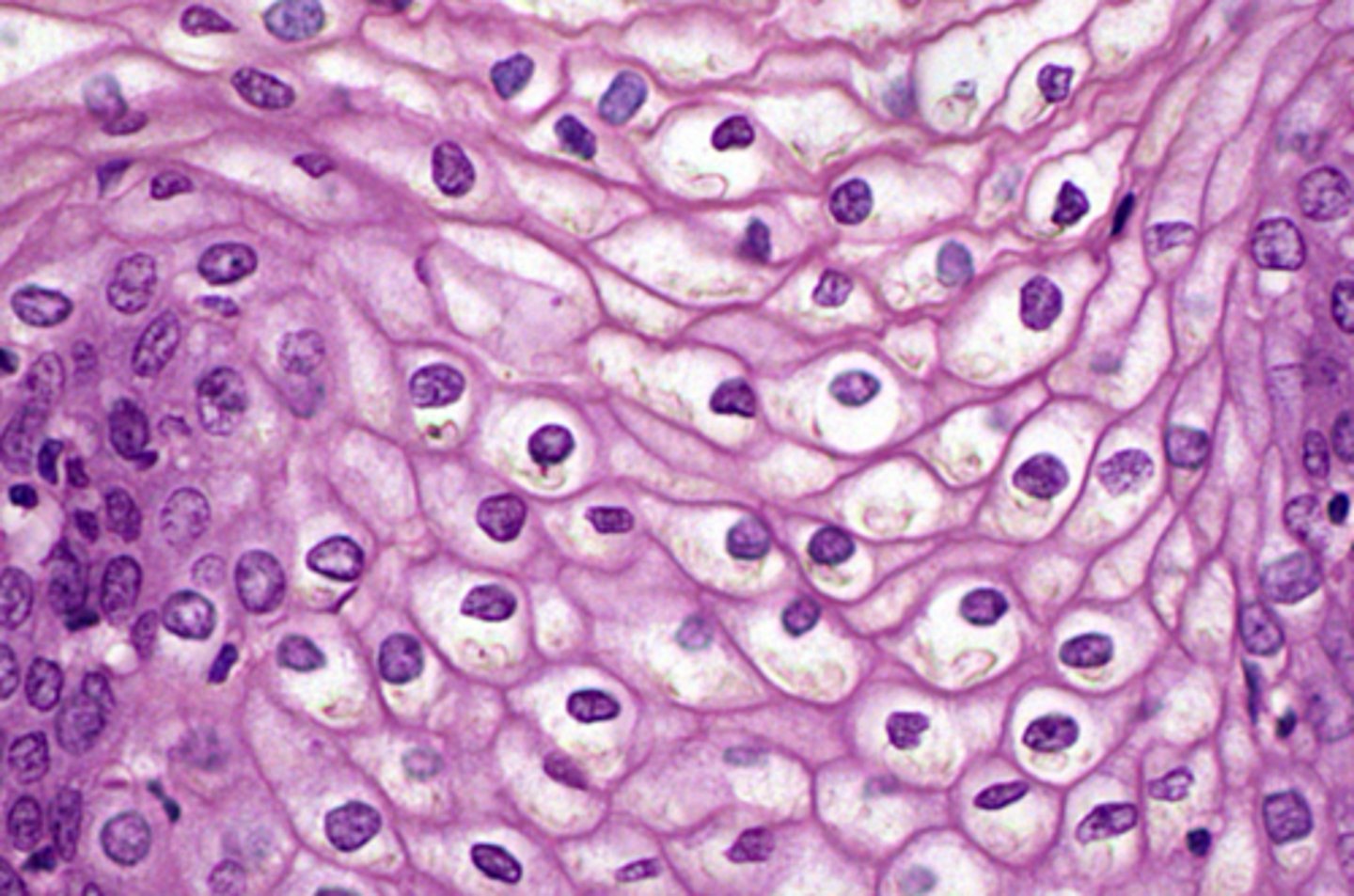 <p>most superficial layer of skin</p>