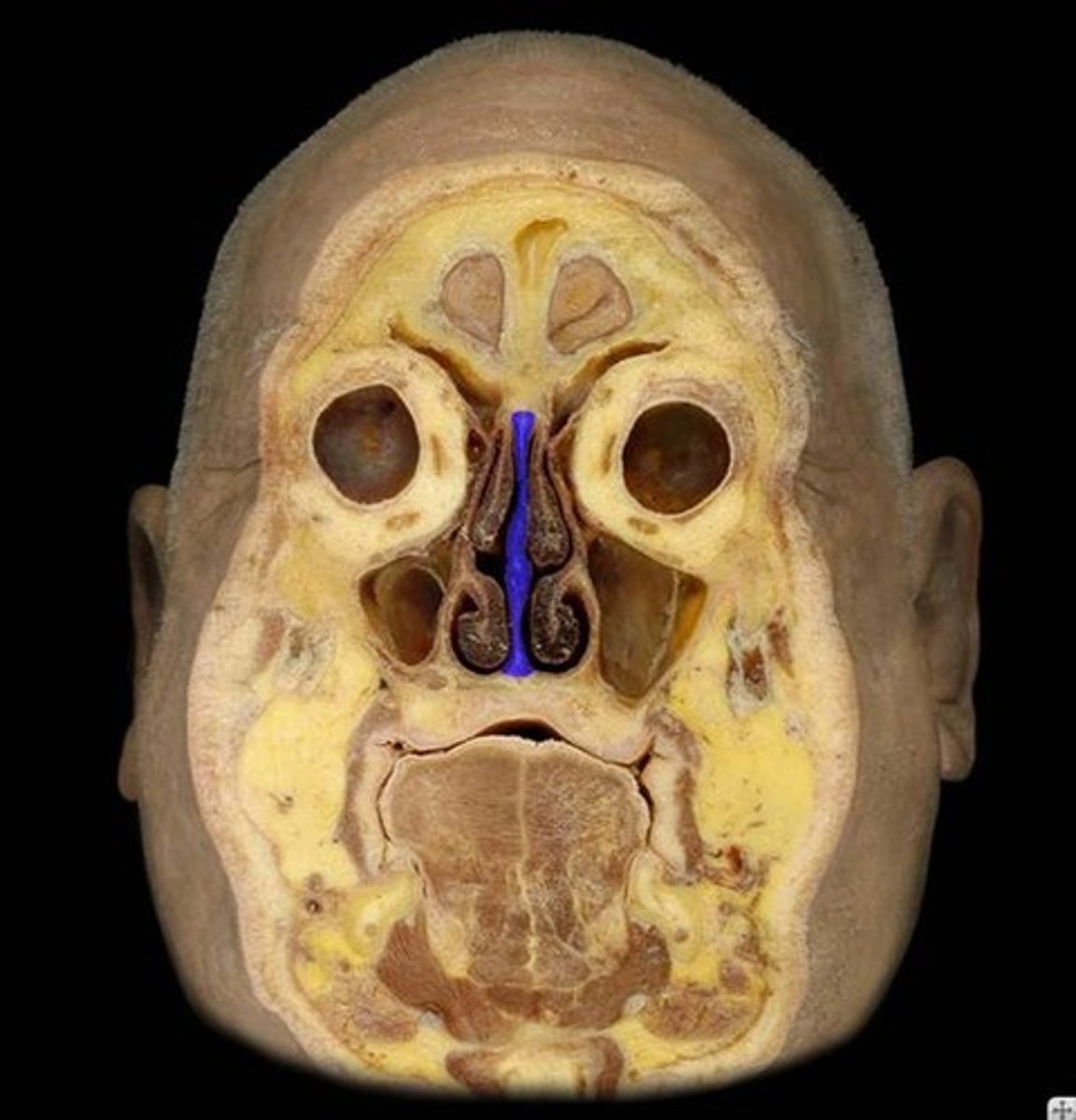 <p>Name this structure.</p>