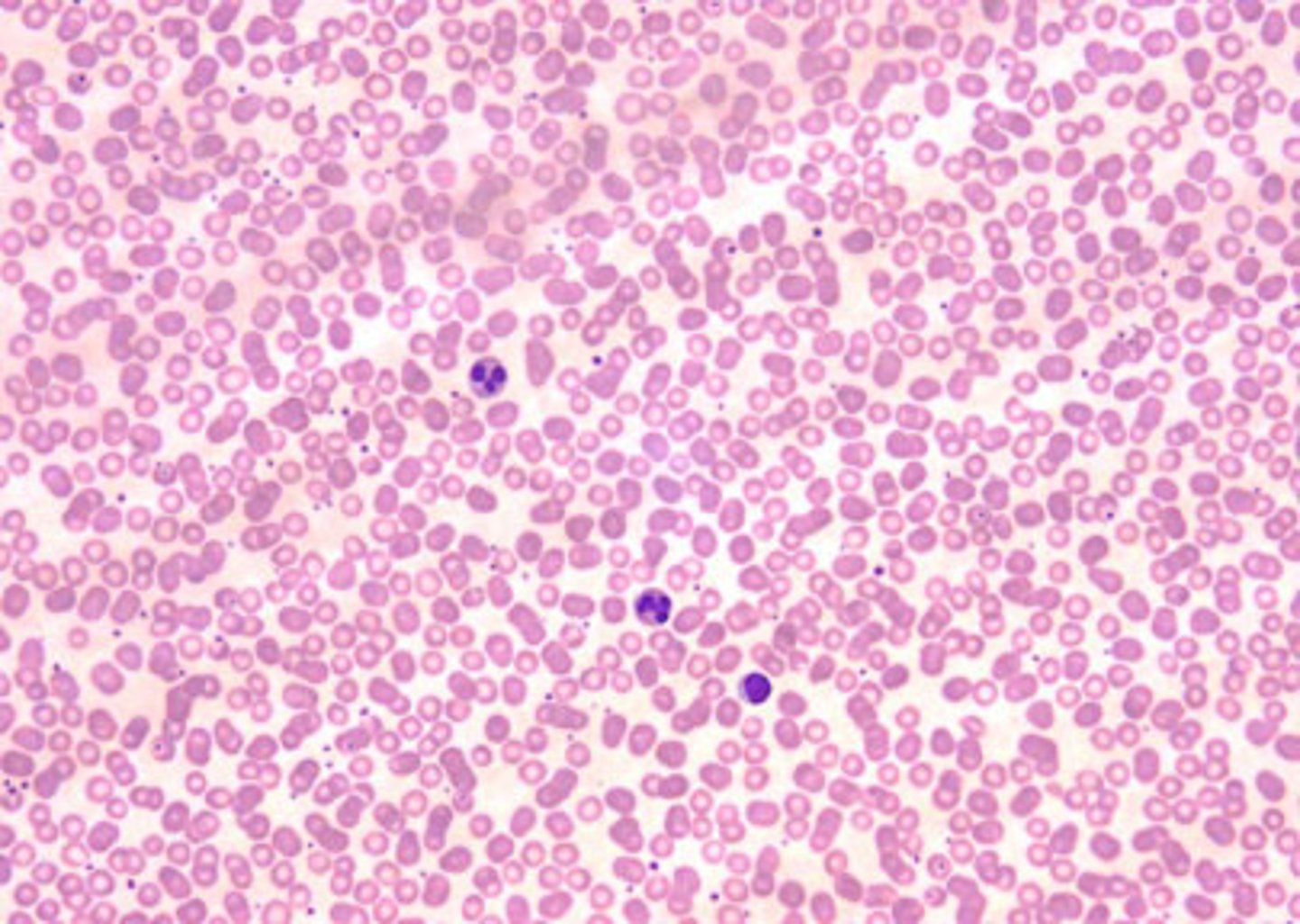 <p>found in the red marrow cavities; responsible for formation of blood and lymphatic system cells; in spleen, tonsils, and lymph nodes</p>