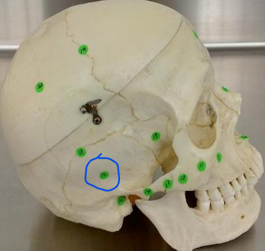 <p>#15 (lateral skull)</p>