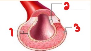 <p>Label the layers of the arterial wall seen here. </p>