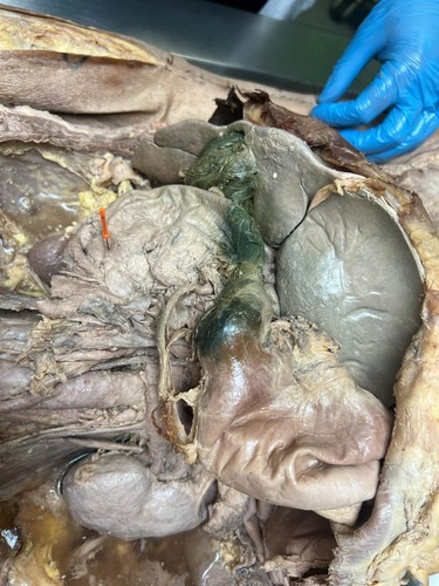 <p>horizontal part of duodenum</p>