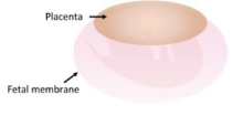 <p>Placenta is discrete disc shape</p><p>Primates, rodents</p>
