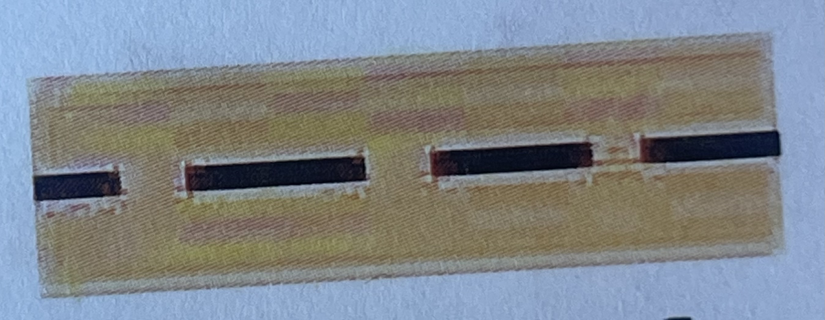 <p>What type of medullary shape is this? </p>