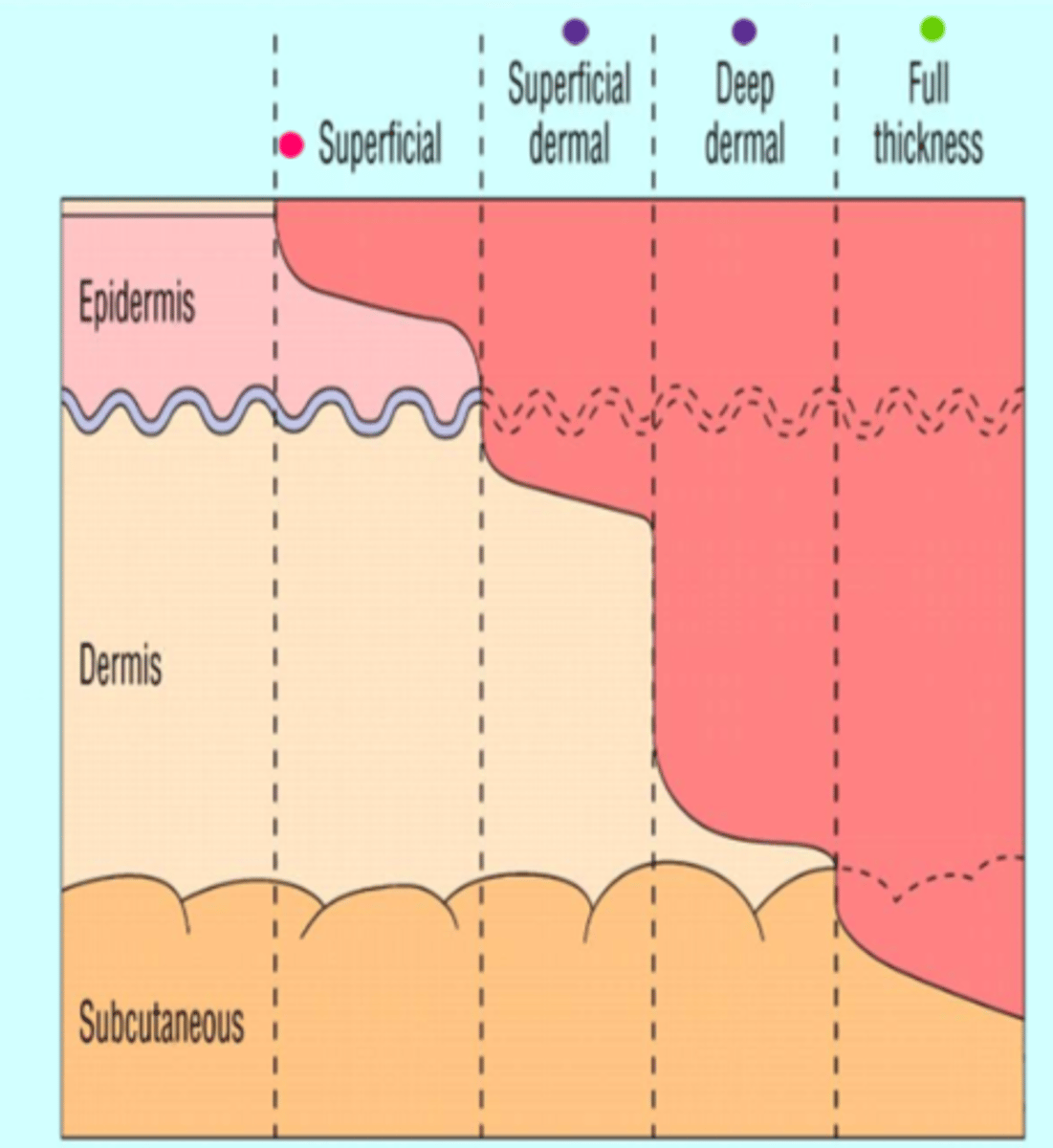 <p>- same as superficial dermal but with more dermis involvement</p><p>- damages hair follicles &amp; glandular tissue</p><p>- less painful, more waxy => cap refill is sluggish/absent</p><p>- healing time: up to 9 weeks (severe scarring needs grafting)</p>