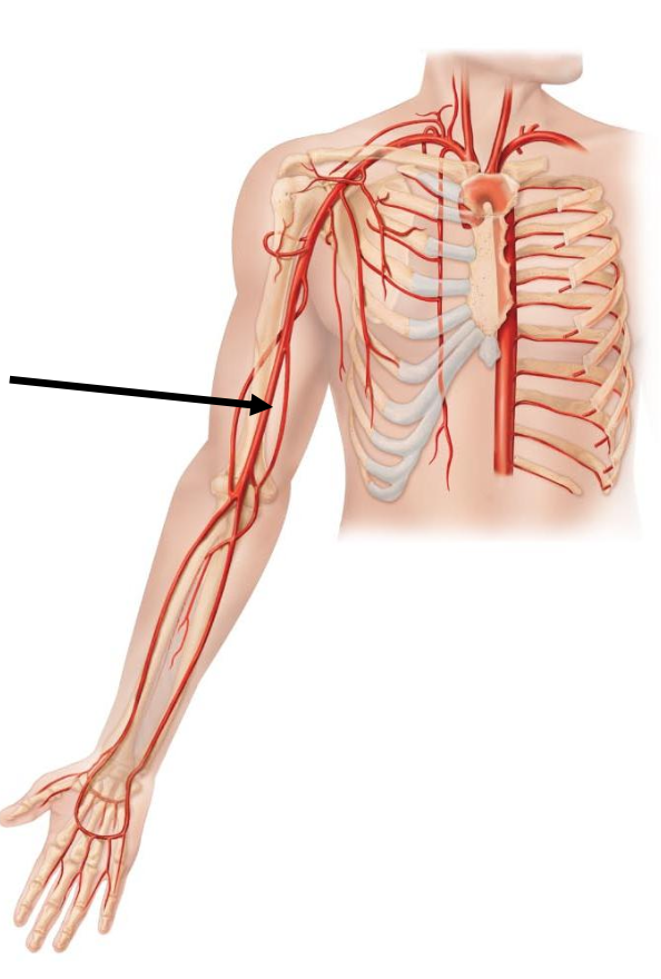 <p>The arrow is pointing to </p><p></p><p>a. Brachiocephalic trunk</p><p>b. Brachial artery</p><p>c. Radial artery</p><p>d. Ulnar artery</p>