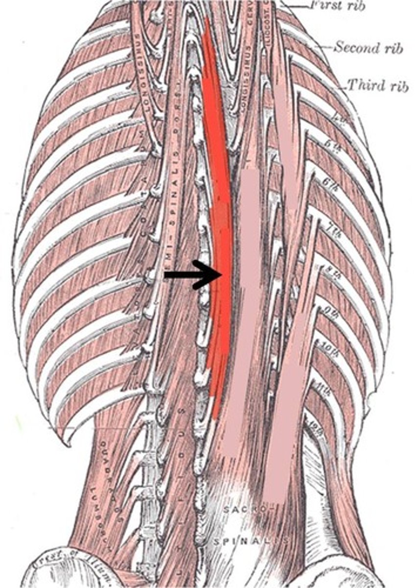 <p>Extends vertebral column and allows lateral flexion (unilateral)</p>