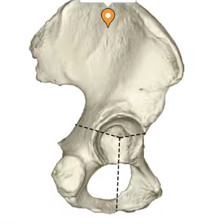 <p>posterior side of the ilium bone in the pelvis (butterfly wing)</p>