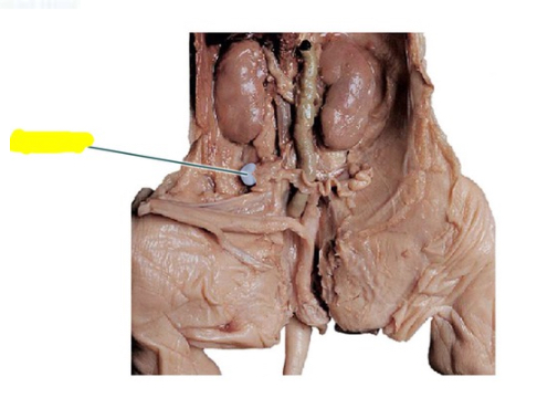 <p>This is…</p>