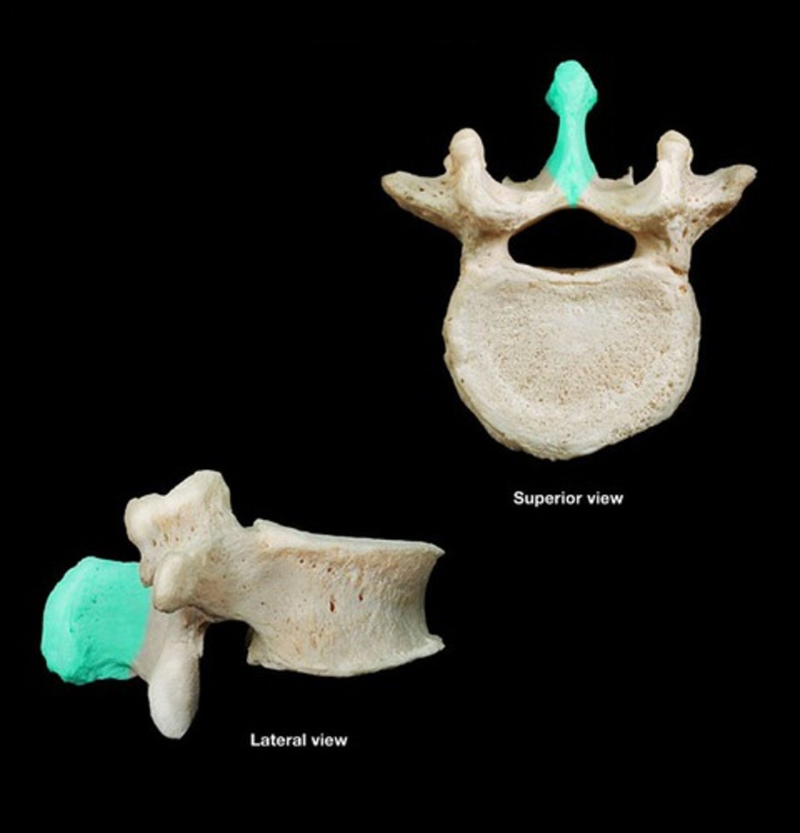 <p>Short and thick compared to other vertebrae</p>