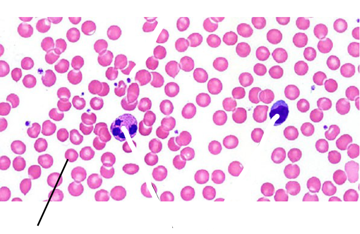 <p>What Type of connective Tissue is this?</p>