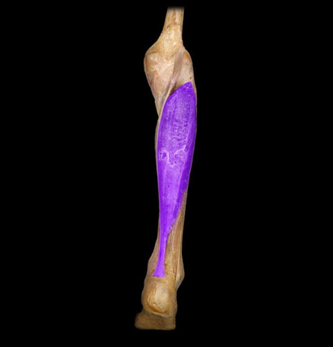 <p>Proximal attachment: Tibia and fibula</p><p>Distal attachment: Calcaneus via calcaneal (achilles) tendon</p><p>Comments, Applications and Relationships: Helpful hint- deep to the gastrocnemius muscle</p><p>Action: Plantar flexor of the foot at the ankle.</p>