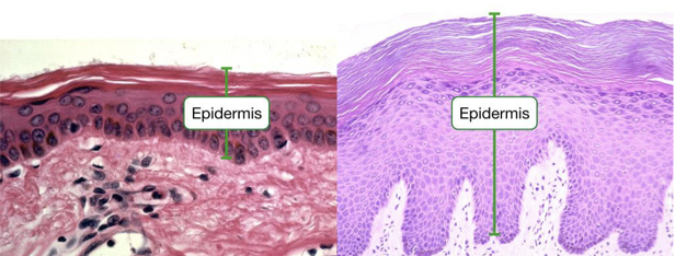 <ul><li><p>Superficial</p></li><li><p>4-5 layers of Stratified Squamous Epithelial tissue</p></li><li><p>Avascular and waterproof (keratin)</p></li><li><p>Resists abrasion, prevents dehydration</p></li></ul>