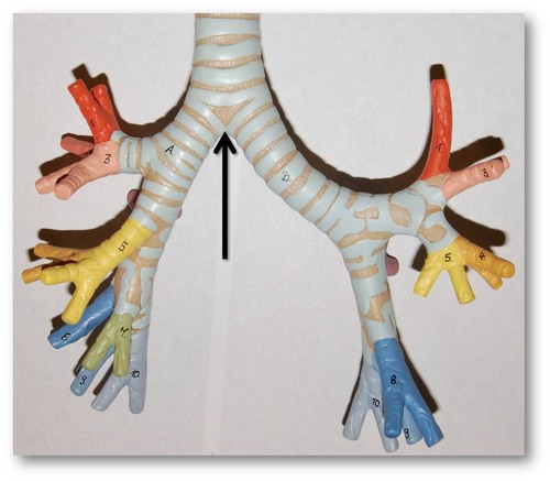 the division of the trachea into the right and left main bronchi