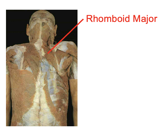 <p>Romboid Major</p><p></p><p>Origin</p><ul><li><p>Spinous process of T2 -T5</p></li></ul><p>Insertation</p><ul><li><p>vertebral border of scapula inferior to root of spine</p></li></ul><p></p><img src="https://knowt-user-attachments.s3.amazonaws.com/d21892ab-07ca-44df-b142-b56499825423.png" data-width="100%" data-align="center"><p></p>