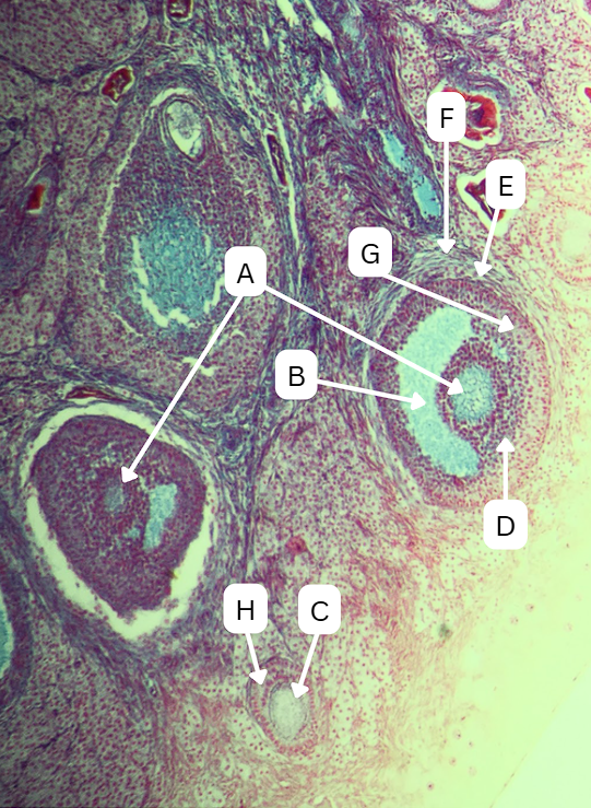 <p>What is the fluid-filled cavity surrounding A?</p>