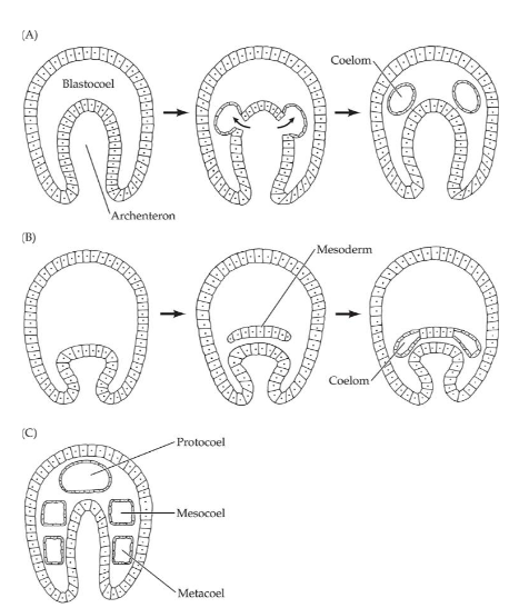 <p>“Pouching”</p><ul><li><p>Entero=intestine</p></li></ul><p></p>