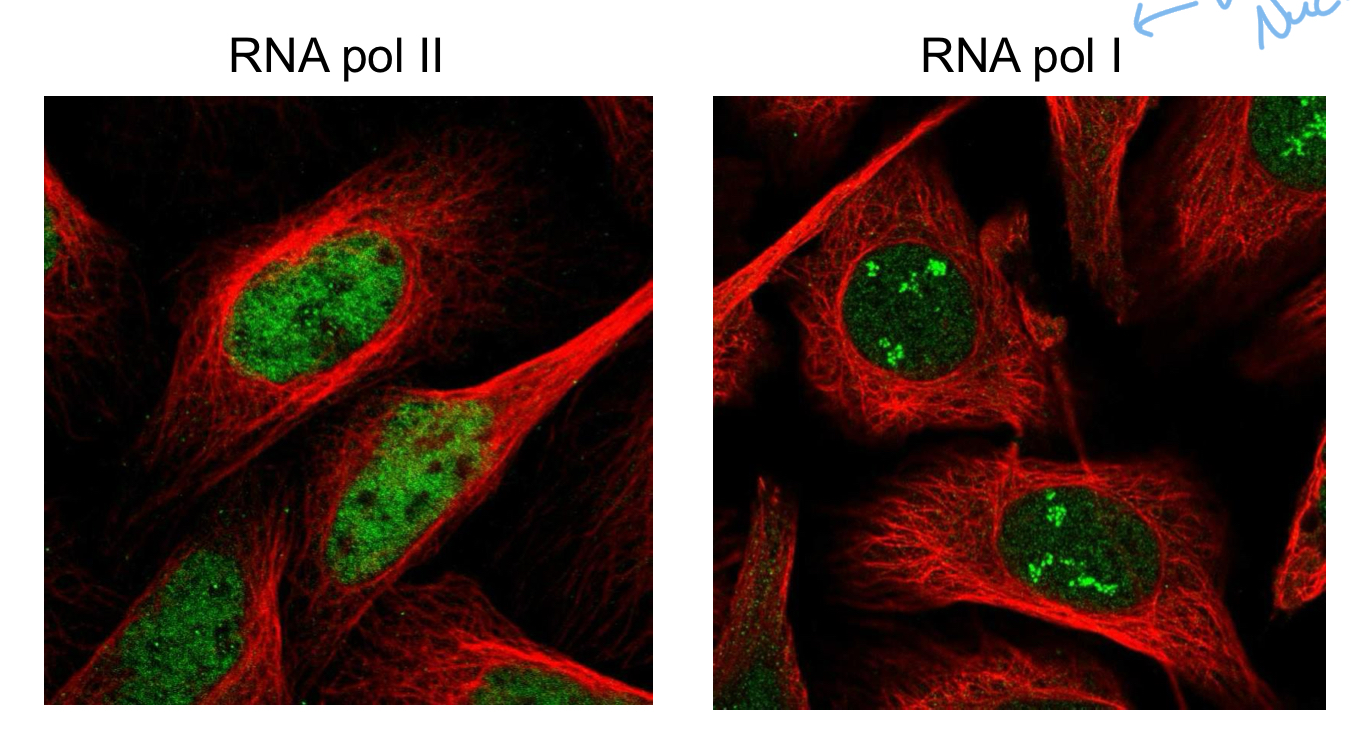 <p>Poly 1 = Nucleolus </p><p>Poly 2 = Nucleoplasm (cytoplasm of the nucleus)</p><p>Poly 3 = Nucleoplasm</p>