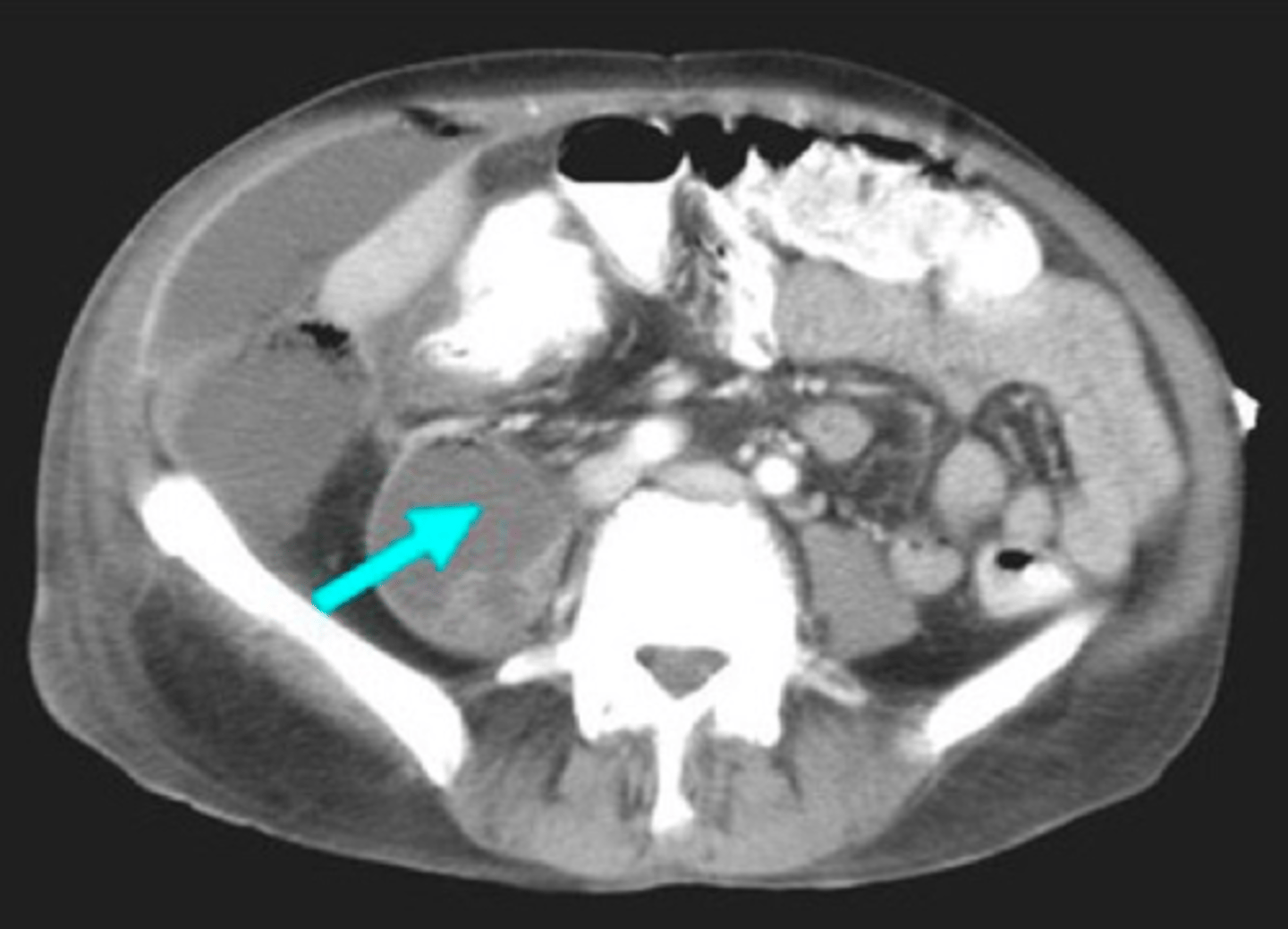 <p><em>identify the pathology</em> </p>