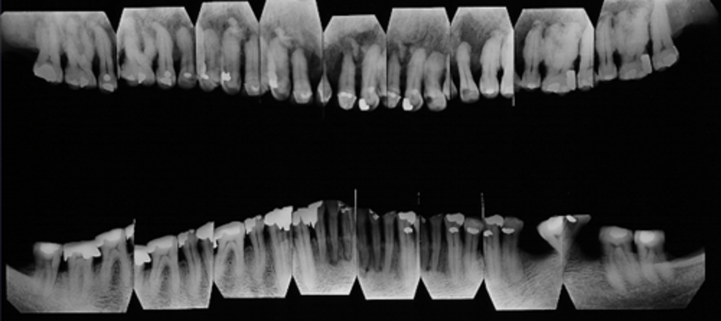 <p>What would be a differential diagnosis for this lesion?</p>