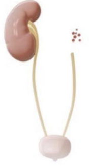 <ul><li><p>Incomplete or defective development of tissue or organ, represented only by a mass of fatty or fibrous tissue, bearing no resemblance to the adult structure </p></li><li><p><strong>Most commonly seen</strong> in one paired structures such as kidneys, gonads, adrenals</p></li></ul><p></p>