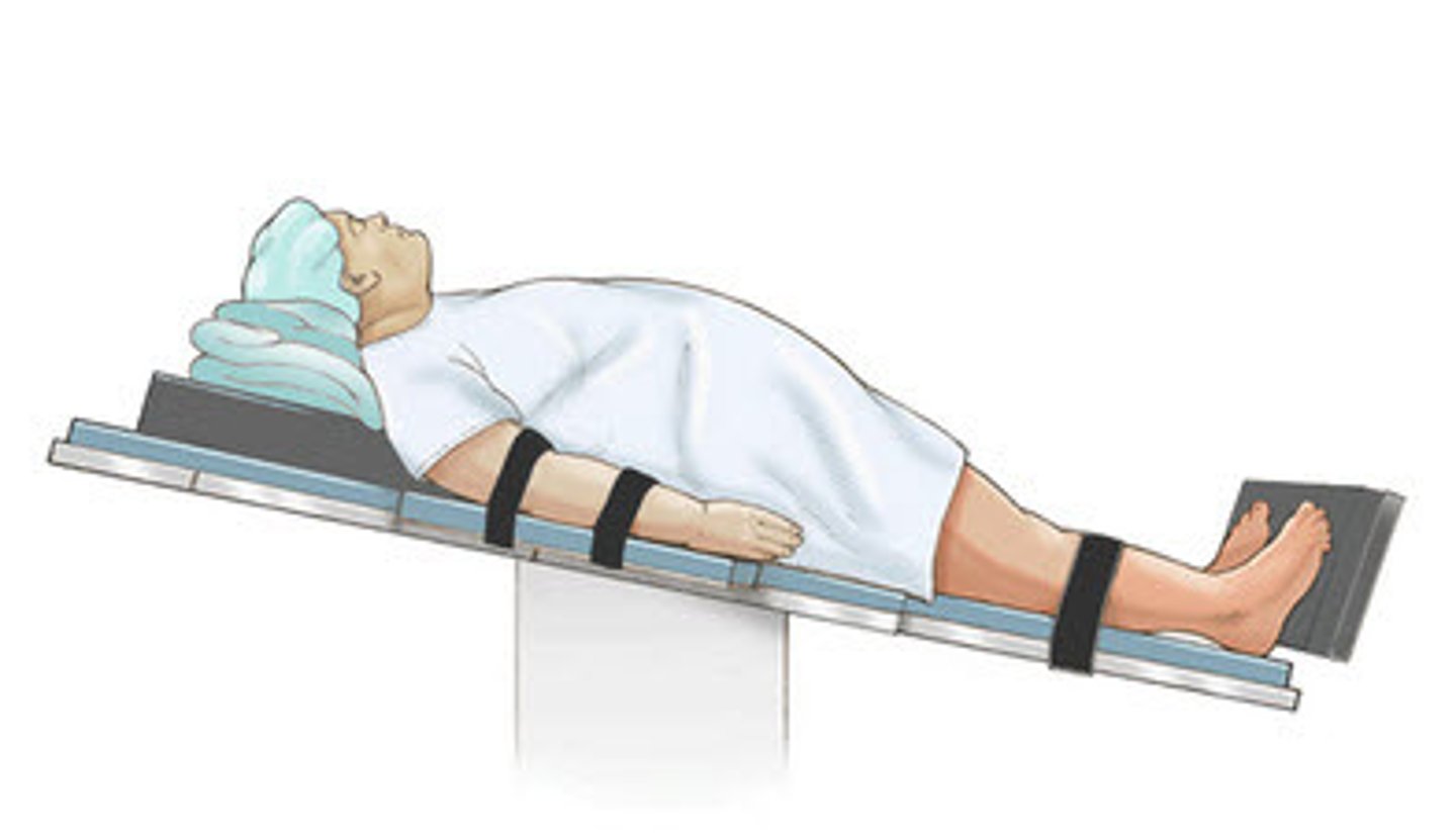 <p>Lying on back with bed tilted so that the head is higher than the feet<br><br>Used for head trauma patients (open wound)</p>