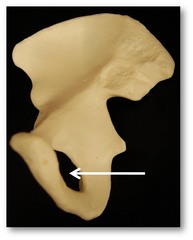 Name this specific part of the pelvic bone.