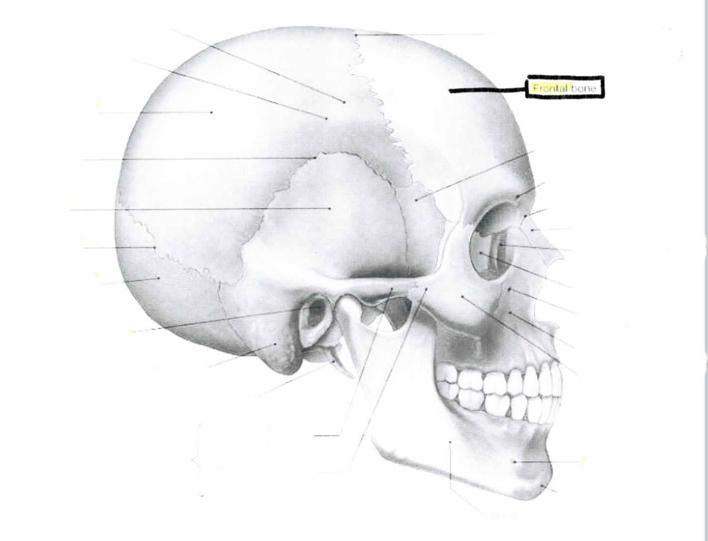 <p>Frontal bone</p>